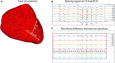 A Novel Model Based on Spatial and Morphological Domains to Predict the Origin of Premature Ventricular Contraction